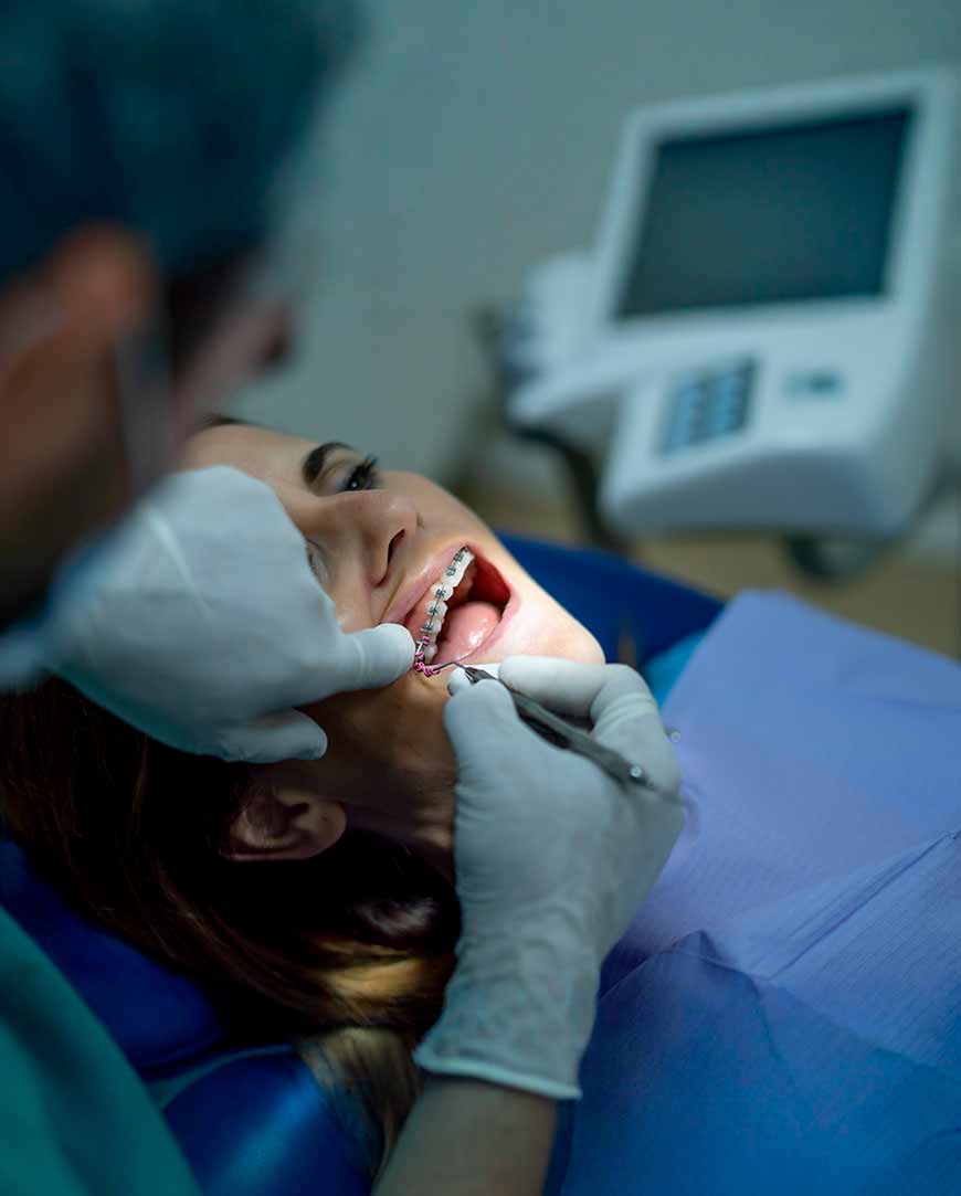 Dental Braces Treatment in Kolkata | Orofacial Polyclinic  Dental Braces Treatment in Kolkata | Orofacial Polyclinic