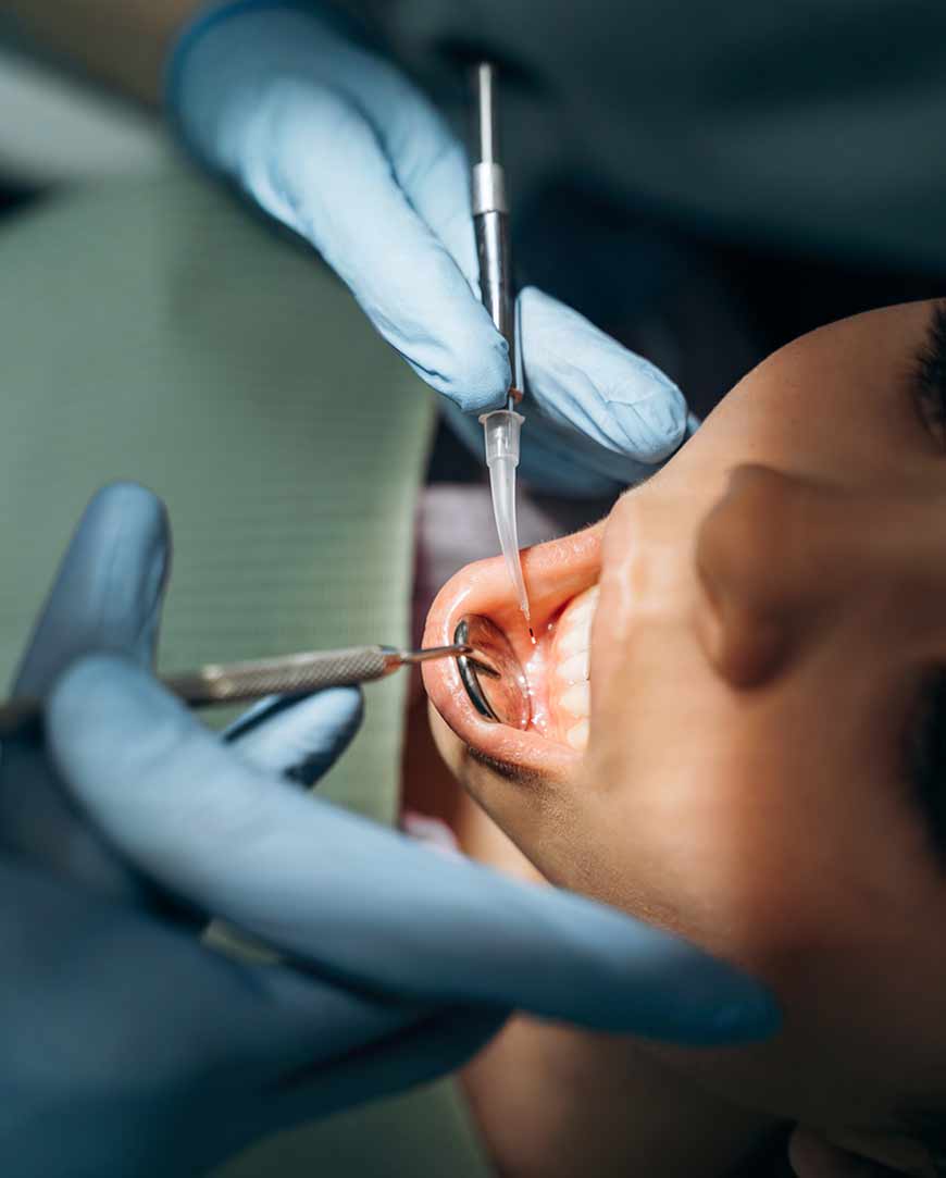 Cyst Removal Surgery in Kolkata | Orofacial Polyclinic  Cyst Removal Surgery in Kolkata | Orofacial Polyclinic