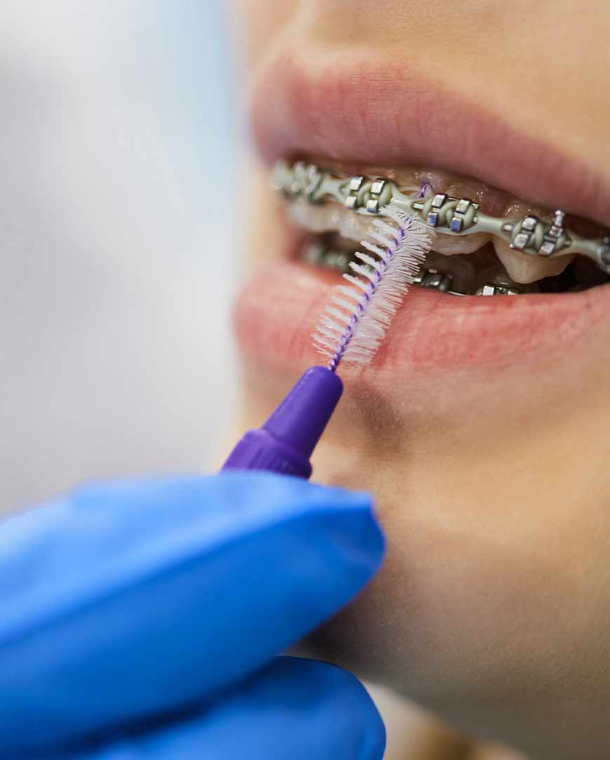 Restore Confidence at Our Orthodontic Dentistry Clinic | Orofacial Polyclinic Restore Confidence at Our Orthodontic Dentistry Clinic | Orofacial Polyclinic