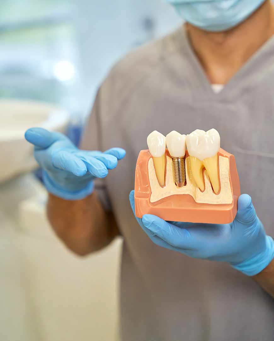 Dental Implants Clinic in Kolkata | Orofacial Polyclinic  Dental Implants Clinic in Kolkata | Orofacial Polyclinic
